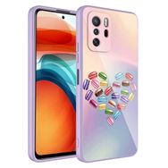 Zore Xiaomi Redmi Note 10 Pro Kamera Korumalı Desenli Sert Silikon Epoksi Kapak Kılıf