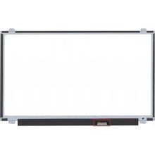 Afila Hp 15-CC107NT 2PR73EA Notebook Ekranı