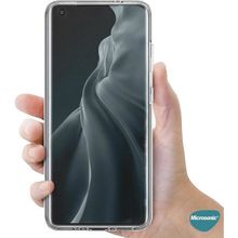 Microsonic Xiaomi Mi 11 6 Tarafı Tam Full Koruma 360 Clear Soft Şeffaf Kılıf