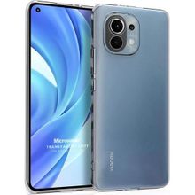 Microsonic Xiaomi Mi 11 Lite Transparent Soft Beyaz Kılıf