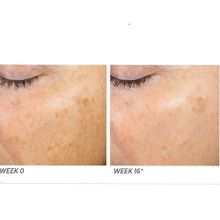 Neostrata Enlighten Illuminating 30 ML Leke Giderici Serum