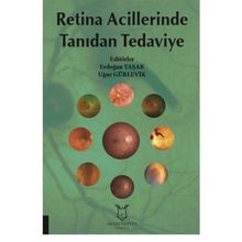 Retina Acillerinde Tanıdan Tedaviye - Kolektif