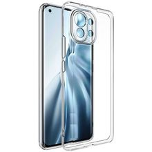 Teleplus Xiaomi Mi 11 Lüks Kamera Korumalı Şeffaf Silikon Cep Telefonu Kılıf