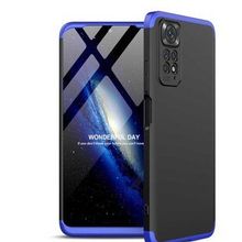 Zore Xiaomi Redmi Note 11 Global Ays Kapak Kılıf