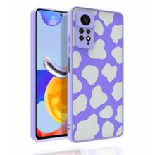 Zore Xiaomi Redmi Note 11 Pro 5G Desenli Kamera Korumalı Parlak Nora Kılıf