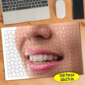 55945 Dentist Diş Hekimi Sağlıklı Dişler 240 Parça Puzzle Yapboz