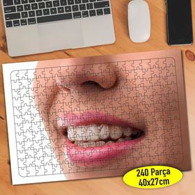 55945 Dentist Diş Hekimi Sağlıklı Dişler 240 Parça Puzzle Yapboz