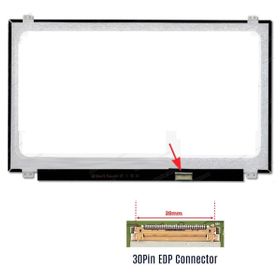 Acer Aspire ES1-524-993P 15.6 Slim 30 Pin 1366X768 Uyumlu Laptop Ekran