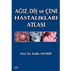 Ağız Diş ve Çene Hastalıkları Atlası - Hakkı Tanyeri
