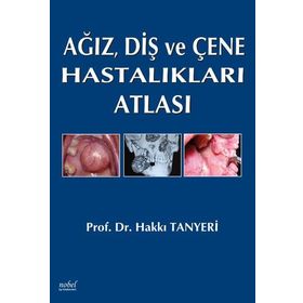 Ağız Diş ve Çene Hastalıkları Atlası - Nobel Tıp Kitabevleri