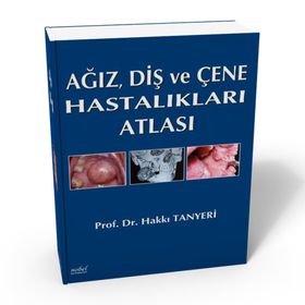 Ağız Diş ve Çene Hastalıkları Atlası - Nobel Tıp Kitabevleri