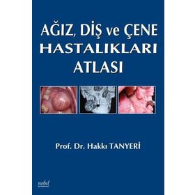 Ağız Diş ve Çene Hastalıkları Atlası - Nobel Tıp Kitabevleri