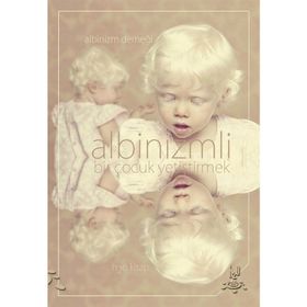 Albinizmli Bir Çocuk Yetiştirmek - Heyet-Kurul-Komisyon