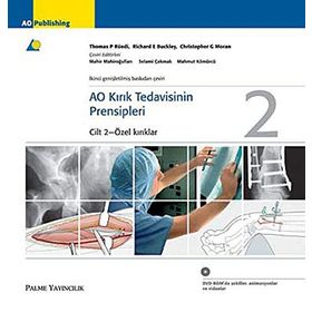 AO KIRIK TEDAVISININ PRENSIPLERI - MAHIR MAHIROĞULLARI
