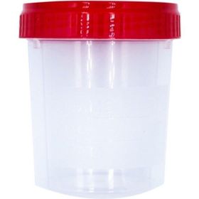 Ayset 100 ml Non Steril 100 Adet Tek Kullanımlık İdrar Numune Kabı
