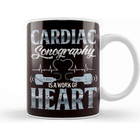 Baskı Dükkanı Cardiac Sonography Ultrasound Echography Medical Diagnostic Kupa Bardak