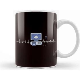 Baskı Dükkanı Sonographer Sonography Heartbeat Ultrasound Echography Kupa
