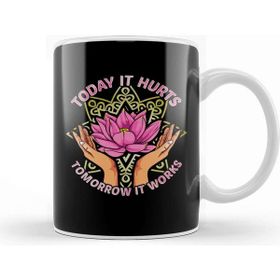 Baskı Dükkanı Today It Hurts Tomorrow It Works Massage Therapis Porselen Beyaz Kupa Bardak