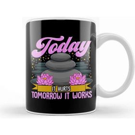 Baskı Dükkanı Today It Hurts Tomorrow It Works Massage Therapist Porselen Beyaz Kupa Bardak