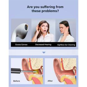 Bebird T5 3 MP 3.5 mm Siyah Şarjlı Wifi Görüntülü Kulak Temizleyici