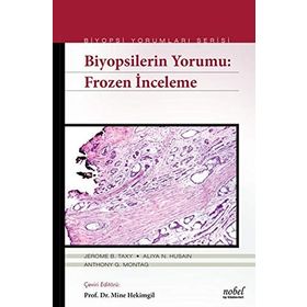 Biyopsilerin Yorumu Frozen İnceleme - Jerome B. Taxy Aliya N. Husain Anthony G. Montag