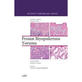 Biyopsilerin Yorumu Prostat - Nobel Tıp Kitabevleri