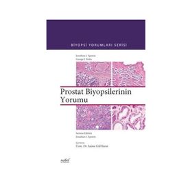 Biyopsilerin Yorumu Prostat - Nobel Tıp Kitabevleri