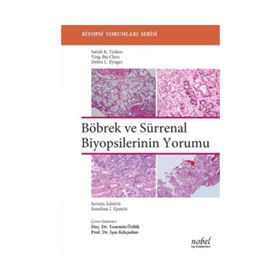 Böbrek ve Sürrenal Biyopsilerinin Yorumu - Satish K. Tickoo