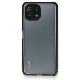 BSSM Miami Şeffaf Silikon - Siyah Xiaomi Mİ 11 Lite Kılıf