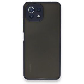 BSSM Montreal Silikon Kapak - Lacivert Xiaomi Mİ 11 Lite Kılıf