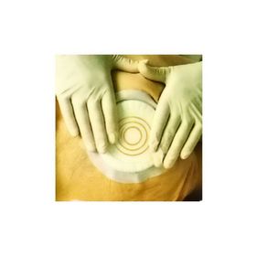 Coloplast Comfeel Hidrokolloid Yara Örtüsü
