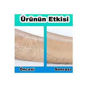 Crystal Hair Eraser Tüy Alma Cihazı