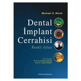 Dental İmplant Cerrahisi Renkli Atlası - Nobel Tıp Kitabevleri