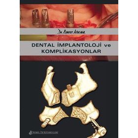 Dental İmplantoloji ve Komplikasyonlar - Nobel Tıp Kitabevleri