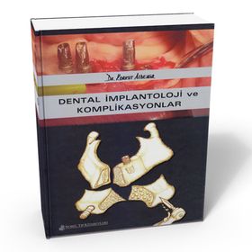 Dental İmplantoloji ve Komplikasyonlar - Nobel Tıp Kitabevleri