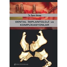 Dental İmplantoloji ve Komplikasyonlar - Nobel Tıp Kitabevleri