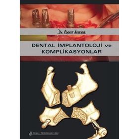 Dental İmplantoloji ve Komplikasyonlar - Nobel Tıp Kitabevleri