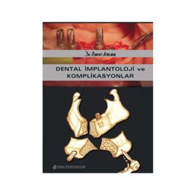 Dental İmplantoloji ve Komplikasyonlar - Nobel Tıp Kitabevleri