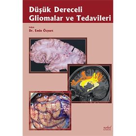Düşük Dereceli Gliomalar ve Tedavileri - Nobel Tıp Kitabevleri