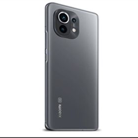 ECR Xiaomi Mi 11 Lite Mat Arka Kaplama