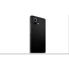 ECR Xiaomi Mi 11 Lite Mat Siyah Arka Kaplama
