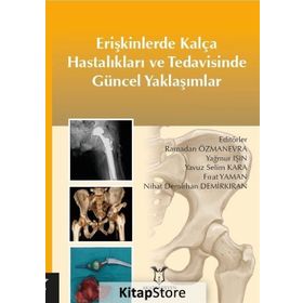 Erişkinlerde Kalça Hastalıkları Ve Tedavisinde Güncel Yaklaşımlar - Kolektif