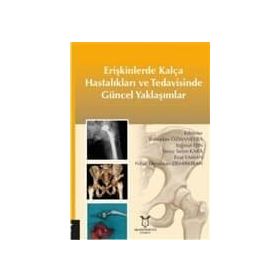 Erişkinlerde Kalça Hastalıkları Ve Tedavisinde Güncel Yaklaşımlar - Kolektif