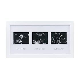 Fufizu 3'lü Bebek Ultrason Anı Çerçevesi