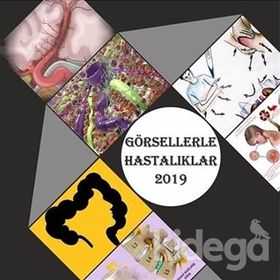 Görsellerle Hastalıklar 2019 - Cengiz Yakıncı