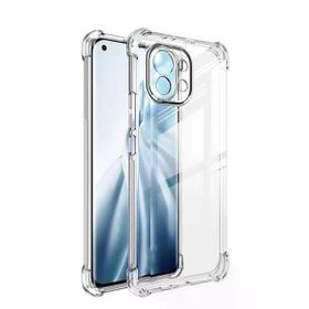 Gpack AntiShock Kamera Korumalı Silikon Xiaomi Mi 11 Kılıf