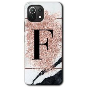 Gramaphone Mi 11 Lite Hd Desen Baskılı Arka Kapak Pembe Mermer Desenli F Harfi Kılıf