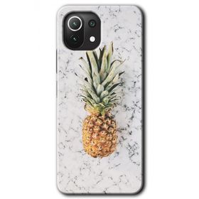 Gramaphone Xiaomi Mi 11 Lite Kılıf HD Desen Baskılı Arka Kapak - Ananas Kılıf