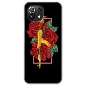 Gramaphone Xiaomi Mi 11 Lite Kılıf HD Desen Baskılı Arka Kapak - Bedel Kılıf