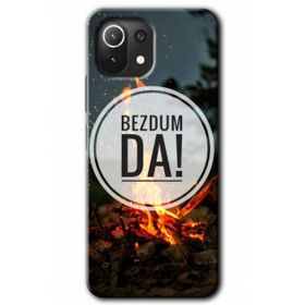 Gramaphone Xiaomi Mi 11 Lite Kılıf HD Desen Baskılı Arka Kapak - Bezdum Da Kılıf